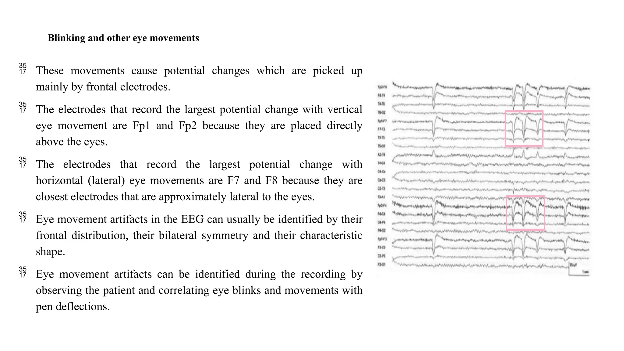 Blinking and other eye movements
 These movements cause potential changes which are picked up
mainly by frontal electrodes.
 The electrodes that record the largest potential change with vertical
eye movement are Fp1 and Fp2 because they are placed directly
above the eyes.
 The electrodes that record the largest potential change with
horizontal (lateral) eye movements are F7 and F8 because they are
closest electrodes that are approximately lateral to the eyes.
 Eye movement artifacts in the EEG can usually be identified by their
frontal distribution, their bilateral symmetry and their characteristic
shape.
 Eye movement artifacts can be identified during the recording by
observing the patient and correlating eye blinks and movements with
pen deflections.
 