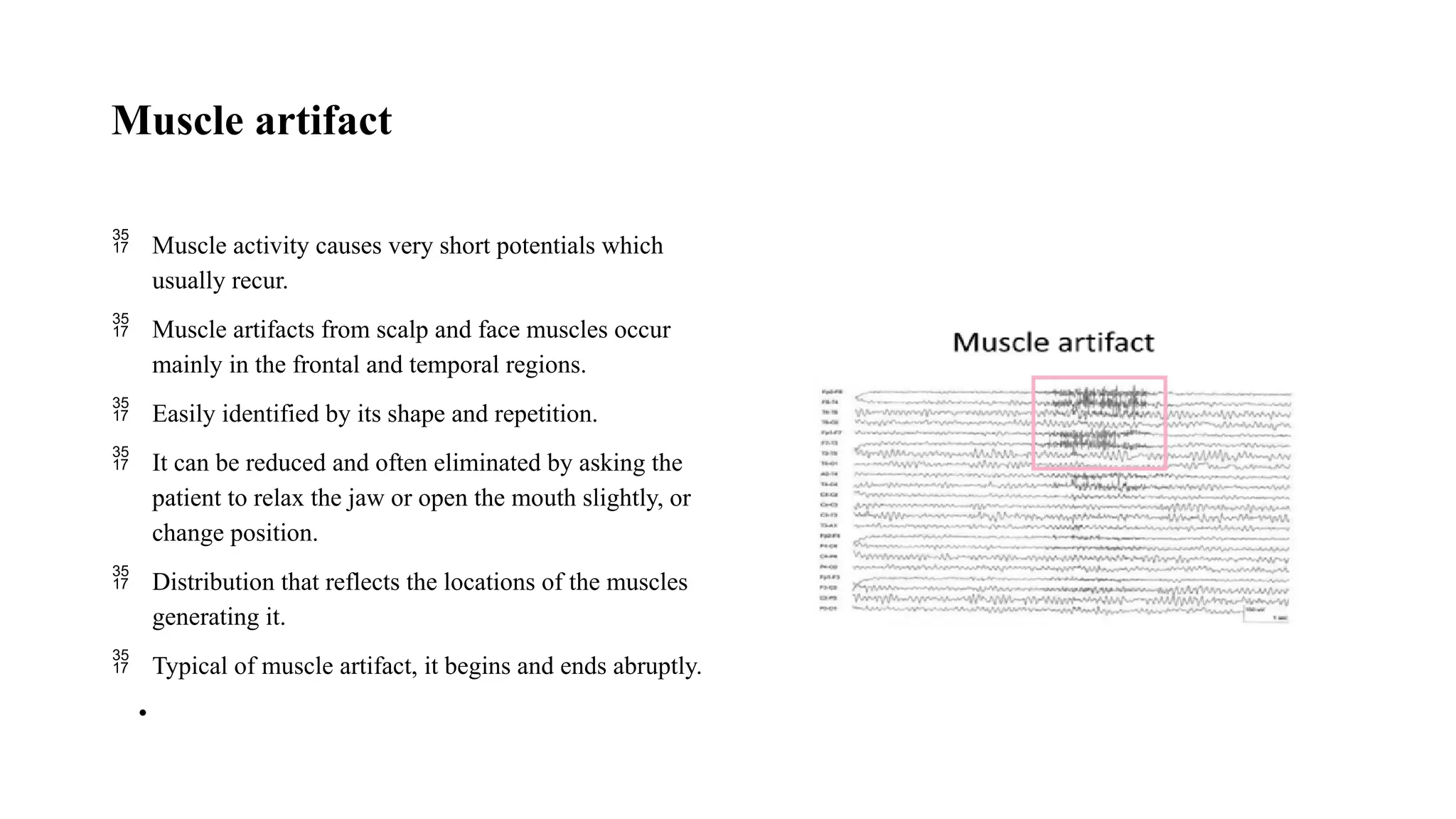 Muscle artifact
 Muscle activity causes very short potentials which
usually recur.
 Muscle artifacts from scalp and face muscles occur
mainly in the frontal and temporal regions.
 Easily identified by its shape and repetition.
 It can be reduced and often eliminated by asking the
patient to relax the jaw or open the mouth slightly, or
change position.
 Distribution that reflects the locations of the muscles
generating it.
 Typical of muscle artifact, it begins and ends abruptly.
•
 
