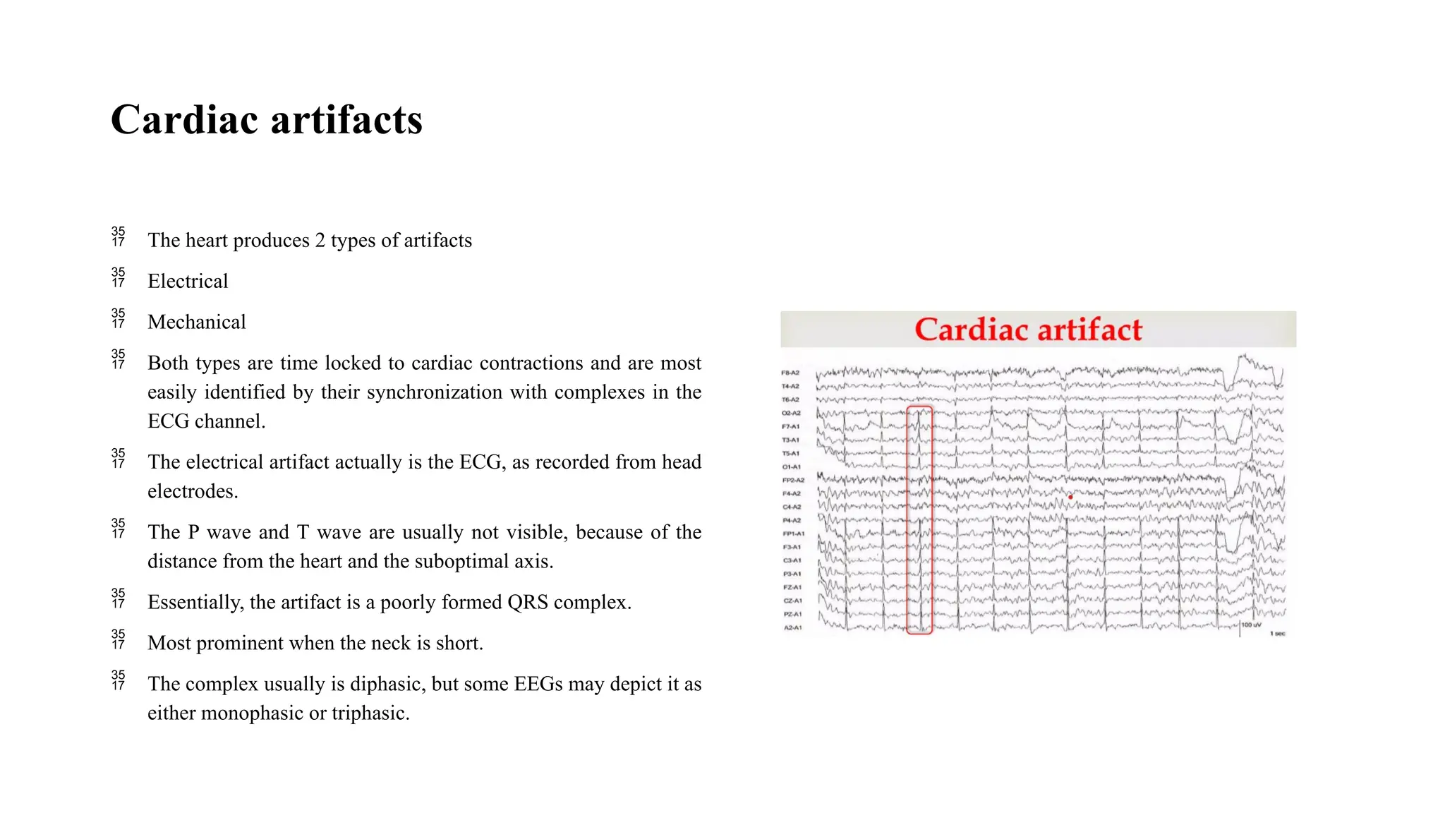 Cardiac artifacts
 The heart produces 2 types of artifacts
 Electrical
 Mechanical
 Both types are time locked to cardiac contractions and are most
easily identified by their synchronization with complexes in the
ECG channel.
 The electrical artifact actually is the ECG, as recorded from head
electrodes.
 The P wave and T wave are usually not visible, because of the
distance from the heart and the suboptimal axis.
 Essentially, the artifact is a poorly formed QRS complex.
 Most prominent when the neck is short.
 The complex usually is diphasic, but some EEGs may depict it as
either monophasic or triphasic.
 