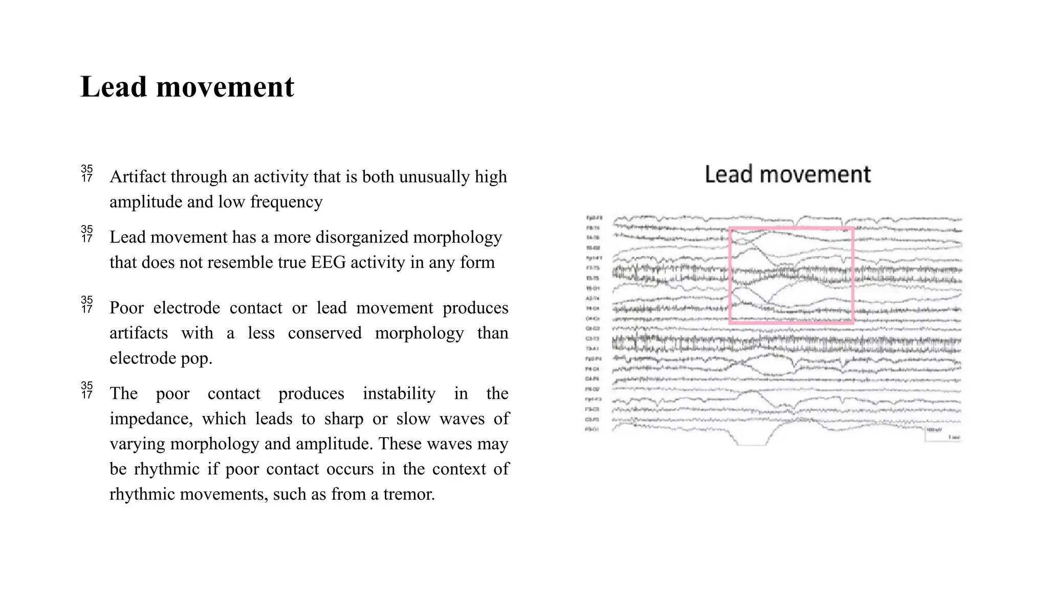 Lead movement
 Artifact through an activity that is both unusually high
amplitude and low frequency
 Lead movement has a more disorganized morphology
that does not resemble true EEG activity in any form
 Poor electrode contact or lead movement produces
artifacts with a less conserved morphology than
electrode pop.
 The poor contact produces instability in the
impedance, which leads to sharp or slow waves of
varying morphology and amplitude. These waves may
be rhythmic if poor contact occurs in the context of
rhythmic movements, such as from a tremor.
 
