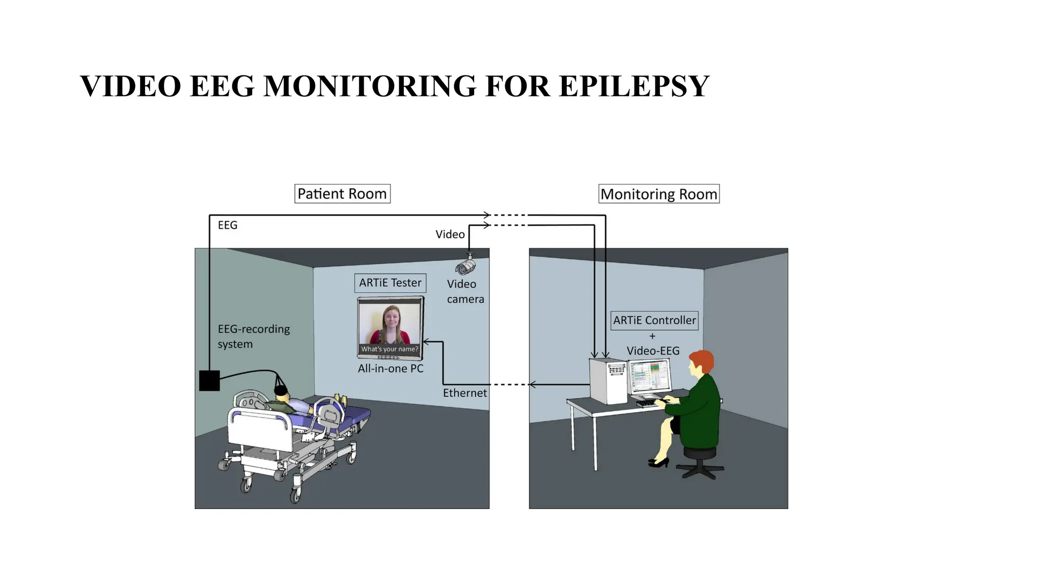 VIDEO EEG MONITORING FOR EPILEPSY
 