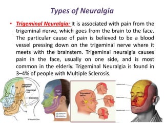 Types of Neuralgia
• Trigeminal Neuralgia: It is associated with pain from the
trigeminal nerve, which goes from the brain to the face.
The particular cause of pain is believed to be a blood
vessel pressing down on the trigeminal nerve where it
meets with the brainstem. Trigeminal neuralgia causes
pain in the face, usually on one side, and is most
common in the elderly. Trigeminal Neuralgia is found in
3–4% of people with Multiple Sclerosis.
 