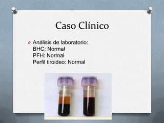 Bhc Normal Neuralgia del nervio glosofaríngeo (1) | PPTX