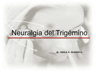 Neuralgia del Trigémino

             Br : PAOLA A. OCANDO U.
 