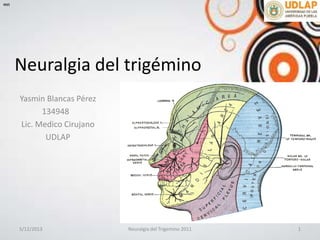 Neuralgia del trigémino
Yasmin Blancas Pérez
134948
Lic. Medico Cirujano
UDLAP
∞π
5/12/2013 1Neuralgia del Trigemino 2011
 