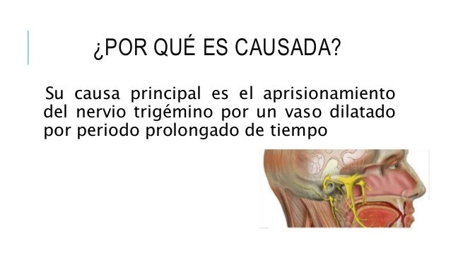 Resultado de imagen de neuralgias CAUSAS