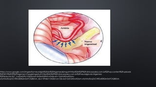 Neuralgia do N.pptx 21/10/2023/ dolownd | PPTX