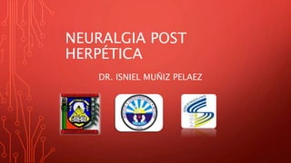 NEURALGIA POST
HERPÉTICA
DR. ISNIEL MUÑIZ PELAEZ
 