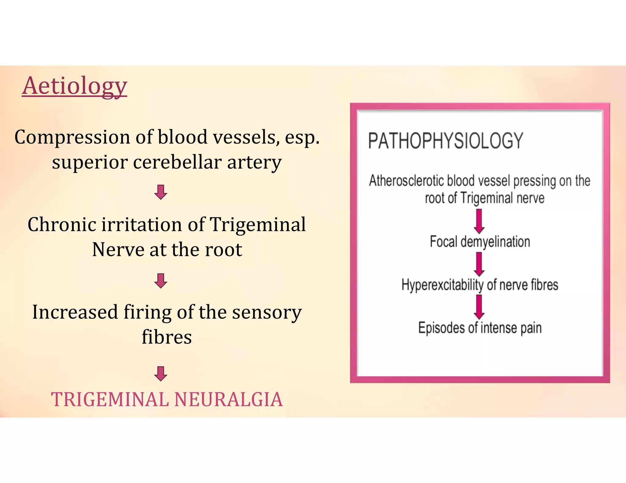 Aetiology
Compression of blood vessels, esp.
superior cerebellar artery
Chronic irritation of Trigeminal
Nerve at the root
Increased firing of the sensory
fibres
TRIGEMINAL NEURALGIA
 