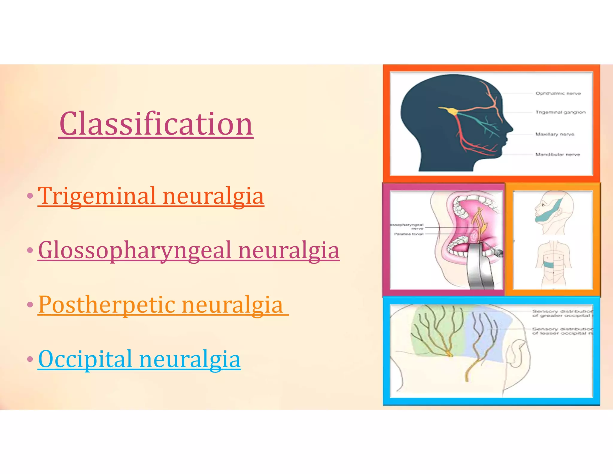 •Trigeminal neuralgia
•Glossopharyngeal neuralgia
•Postherpetic neuralgia
•Occipital neuralgia
 