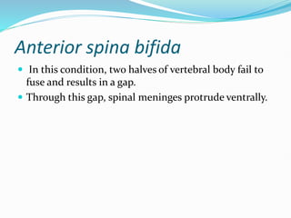 Anterior spina bifida
 In this condition, two halves of vertebral body fail to
fuse and results in a gap.
 Through this gap, spinal meninges protrude ventrally.
 