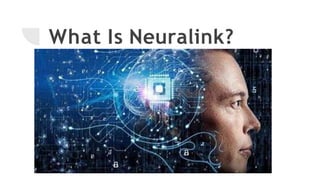 What Is Neuralink?
 
