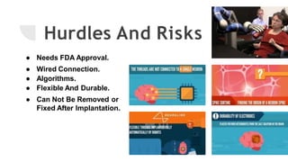 Hurdles And Risks
● Needs FDA Approval.
● Wired Connection.
● Algorithms.
● Flexible And Durable.
● Can Not Be Removed or
Fixed After Implantation.
 