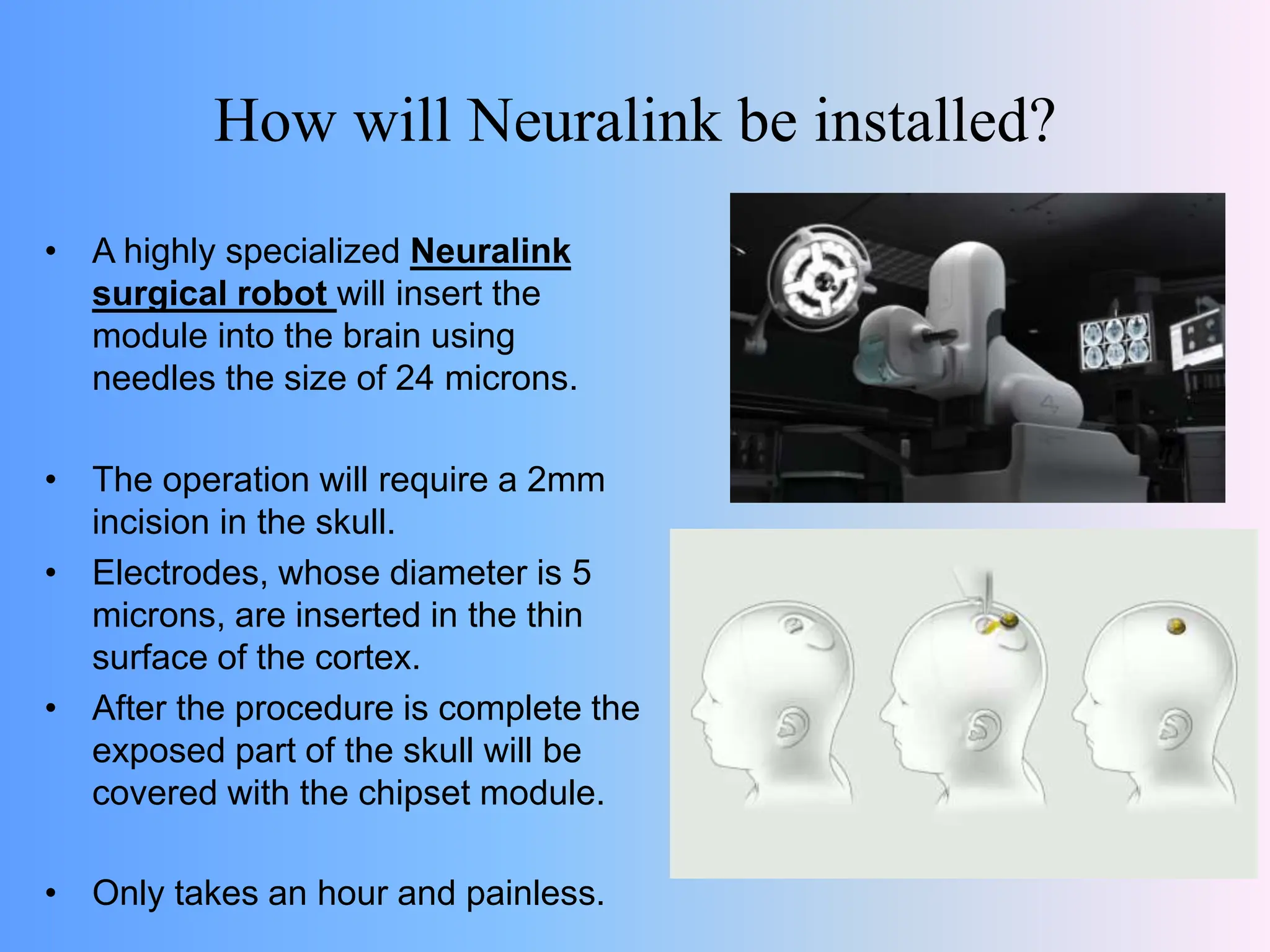 How will Neuralink be installed?
• A highly specialized Neuralink
surgical robot will insert the
module into the brain using
needles the size of 24 microns.
• The operation will require a 2mm
incision in the skull.
• Electrodes, whose diameter is 5
microns, are inserted in the thin
surface of the cortex.
• After the procedure is complete the
exposed part of the skull will be
covered with the chipset module.
• Only takes an hour and painless.
 