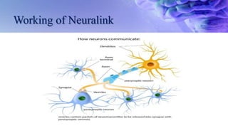 Neuralink_seminar.pptx