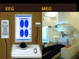 EEG   MEG
 