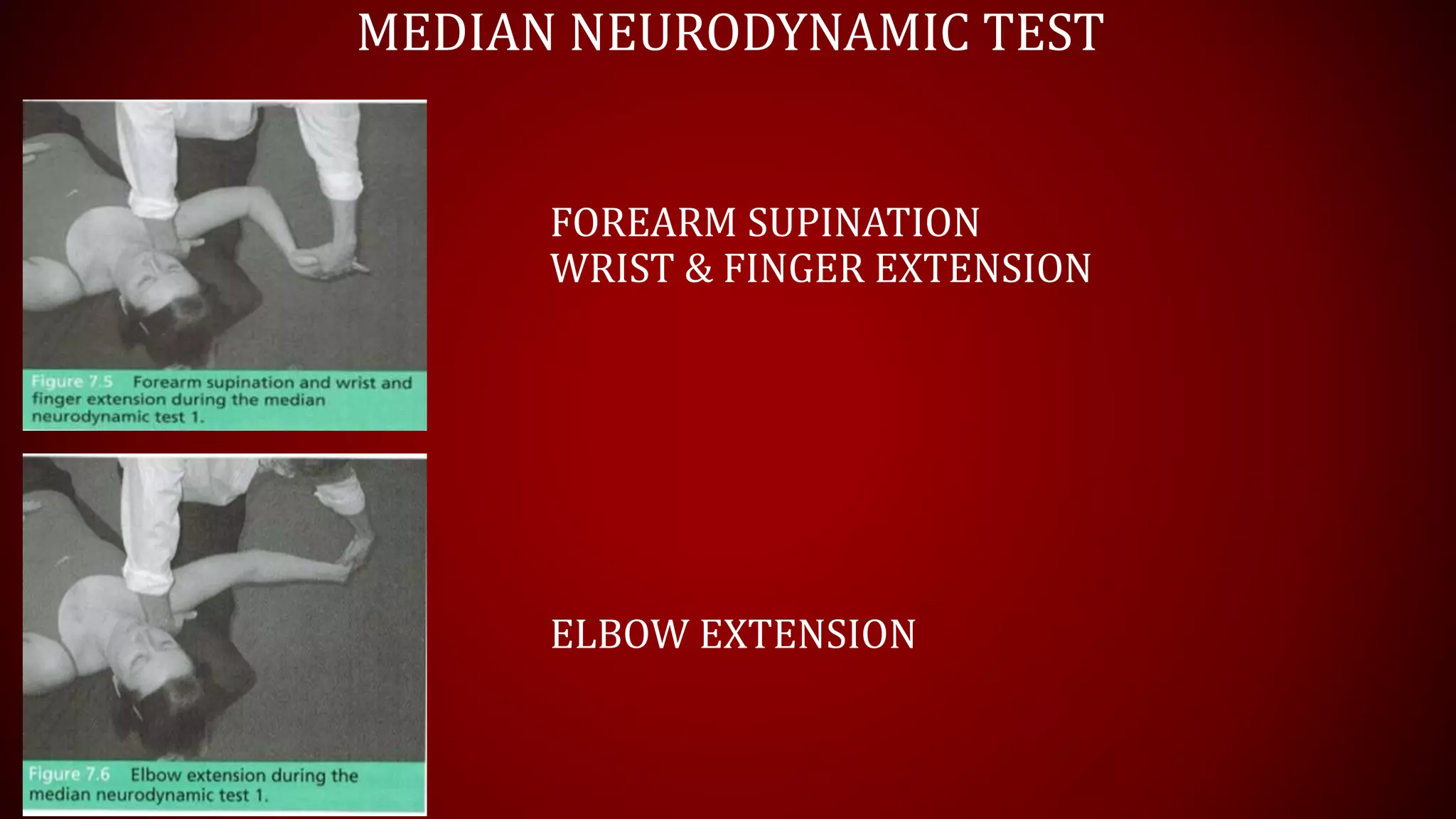 MEDIAN NEURODYNAMIC TEST
FOREARM SUPINATION
WRIST & FINGER EXTENSION
ELBOW EXTENSION
 