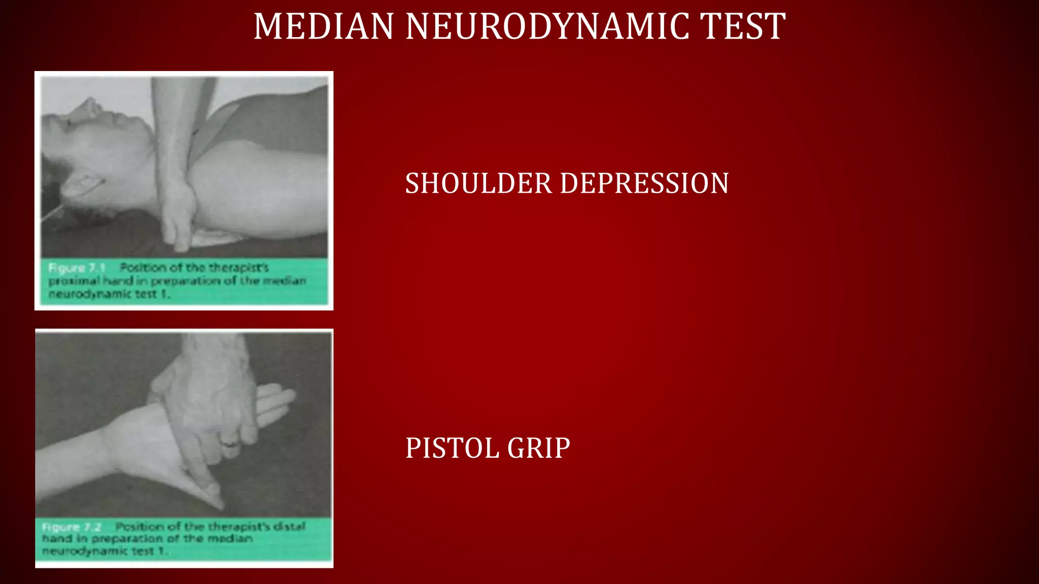 MEDIAN NEURODYNAMIC TEST
SHOULDER DEPRESSION
PISTOL GRIP
 