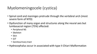 Myelomeningocele (cystica)
• Spinal cord and meninges protrude through the vertebral arch (most
severe form of NTD)
• Dysfunction of many organ and structures along the neural axis but
lumbasacral region (75%) affected:
• Peripheral NS
• Skeleton
• Skin
• GIT
• Genitourinary tract
• Hydrocephalus occur in associated with type II Chiari-Malformation
 