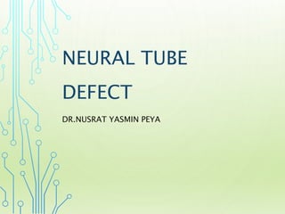 NEURAL TUBE
DEFECT
DR.NUSRAT YASMIN PEYA
 