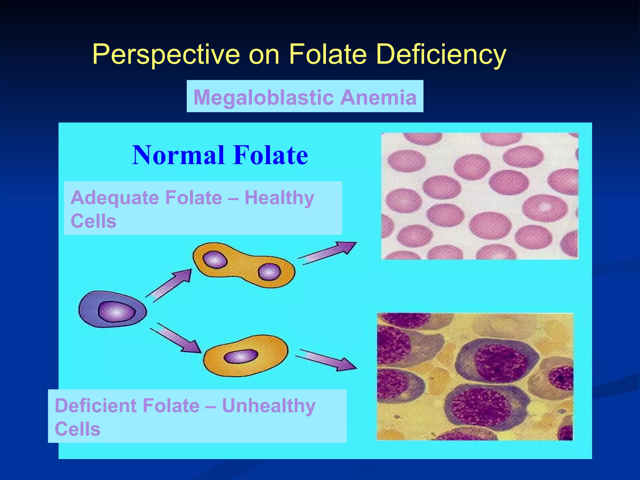 Normal Folate Adequate Folate – Healthy Cells Deficient Folate – Unhealthy Cells Perspective on Folate Deficiency Megaloblastic Anemia 