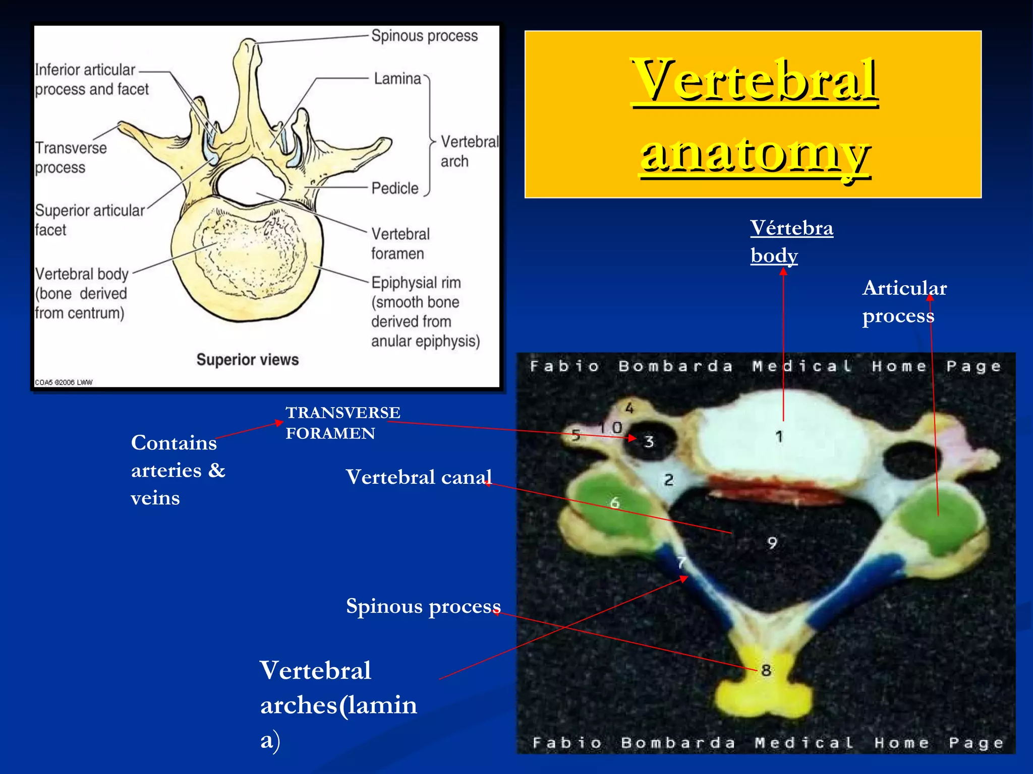 Vertebral anatomy Vertebral arches(lamina ) Spinous process Vertebral canal Vértebra body TRANSVERSE FORAMEN Articular process Contains arteries & veins 