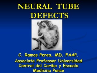 NEURAL  TUBE  DEFECTS C. Ramos Perea, MD. FAAP. Associate Professor Universidad Central del Caribe y Escuela Medicina Ponce 