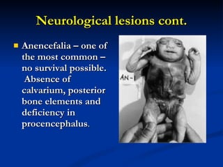 Neurological lesions cont. Anencefalia – one of the most common – no survival possible.  Absence of calvarium, posterior bone elements and deficiency in procencephalus . 