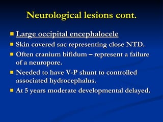 Neurological lesions cont. Large occipital encephalocele Skin covered sac representing close NTD. Often cranium bifidum – represent a failure of a neuropore. Needed to have V-P shunt to controlled associated hydrocephalus. At 5 years moderate developmental delayed. 