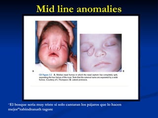 Mid line anomalies “ El bosque seria muy triste si solo cantaran los pájaros que lo hacen mejor”rabindranath tagore 