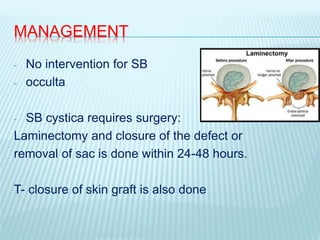 MANAGEMENT
- No intervention for SB
- occulta
- SB cystica requires surgery:
Laminectomy and closure of the defect or
removal of sac is done within 24-48 hours.
T- closure of skin graft is also done
 