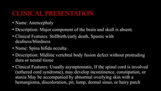 CLINICAL PRESENTATION
• Name: Anencephaly
• Description: Major component of the brain and skull is absent.
• Clinical Features: Stillbirth/early death, Spastic with
deafness/blindness
• Name: Spina bifida occulta
• Description: Midline vertebral body fusion defect without protruding
dura or neural tissue
• Clinical Features: Usually asymptomatic, If the spinal cord is involved
(tethered cord syndrome), may develop incontinence, constipation, or
ataxia May be accompanied by abnormal overlying skin with a
hemangioma, discoloration, pit, lump, dermal sinus, or hairy patch
 