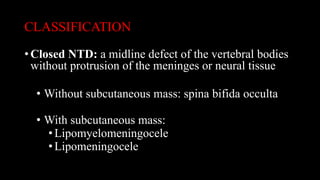 CLASSIFICATION
• Closed NTD: a midline defect of the vertebral bodies
without protrusion of the meninges or neural tissue
• Without subcutaneous mass: spina bifida occulta
• With subcutaneous mass:
•Lipomyelomeningocele
•Lipomeningocele
 
