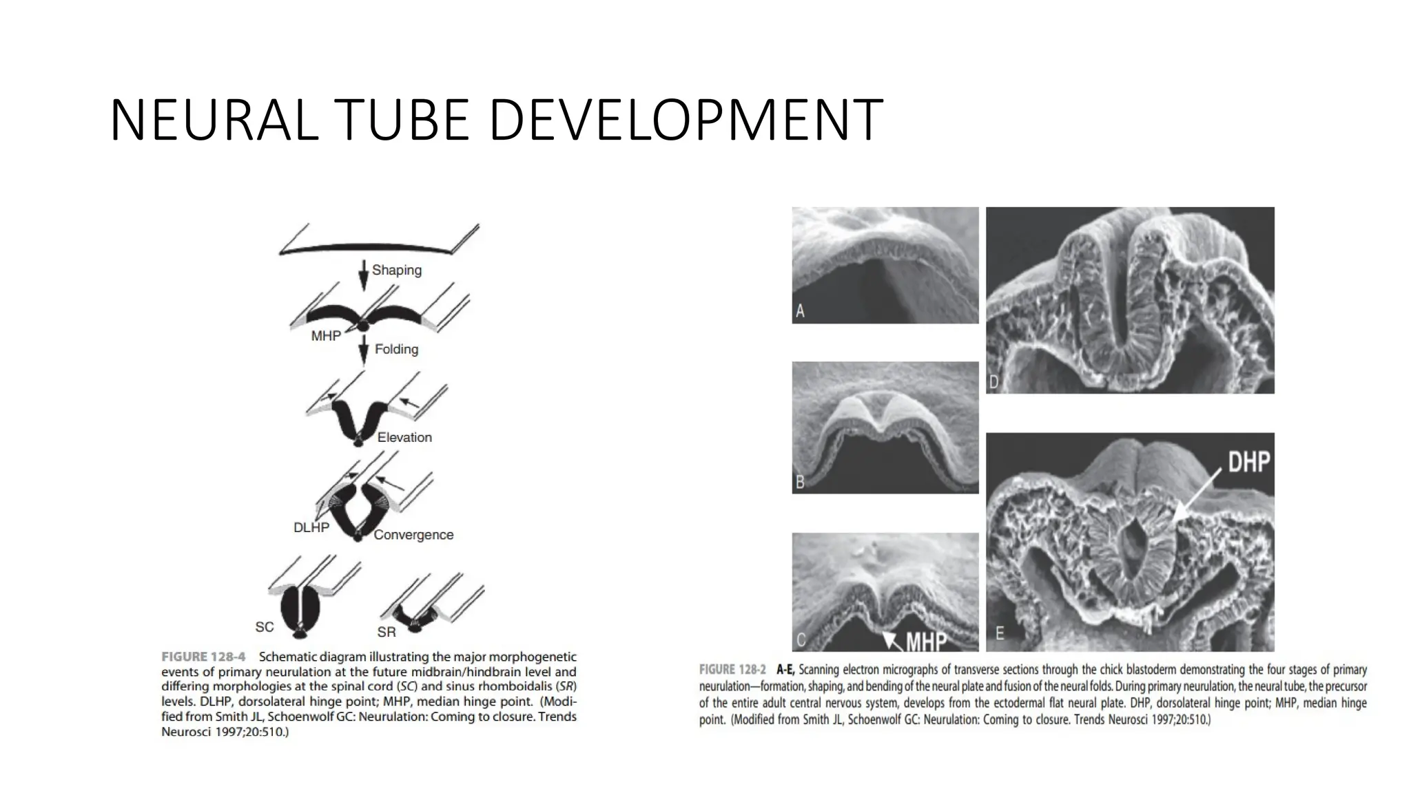 Neural Tube Defects in children - paediatric surgery | PPT