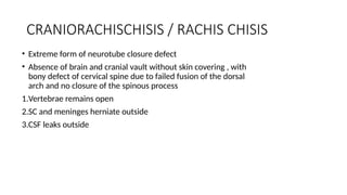 CRANIORACHISCHISIS / RACHIS CHISIS
• Extreme form of neurotube closure defect
• Absence of brain and cranial vault without skin covering , with
bony defect of cervical spine due to failed fusion of the dorsal
arch and no closure of the spinous process
1.Vertebrae remains open
2.SC and meninges herniate outside
3.CSF leaks outside
 