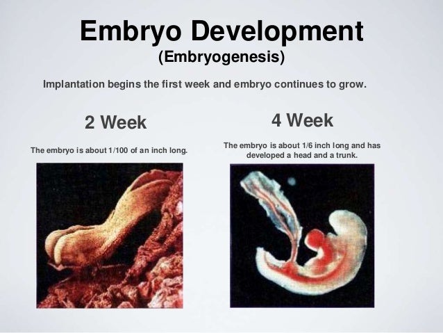 photo of 7 week fetus