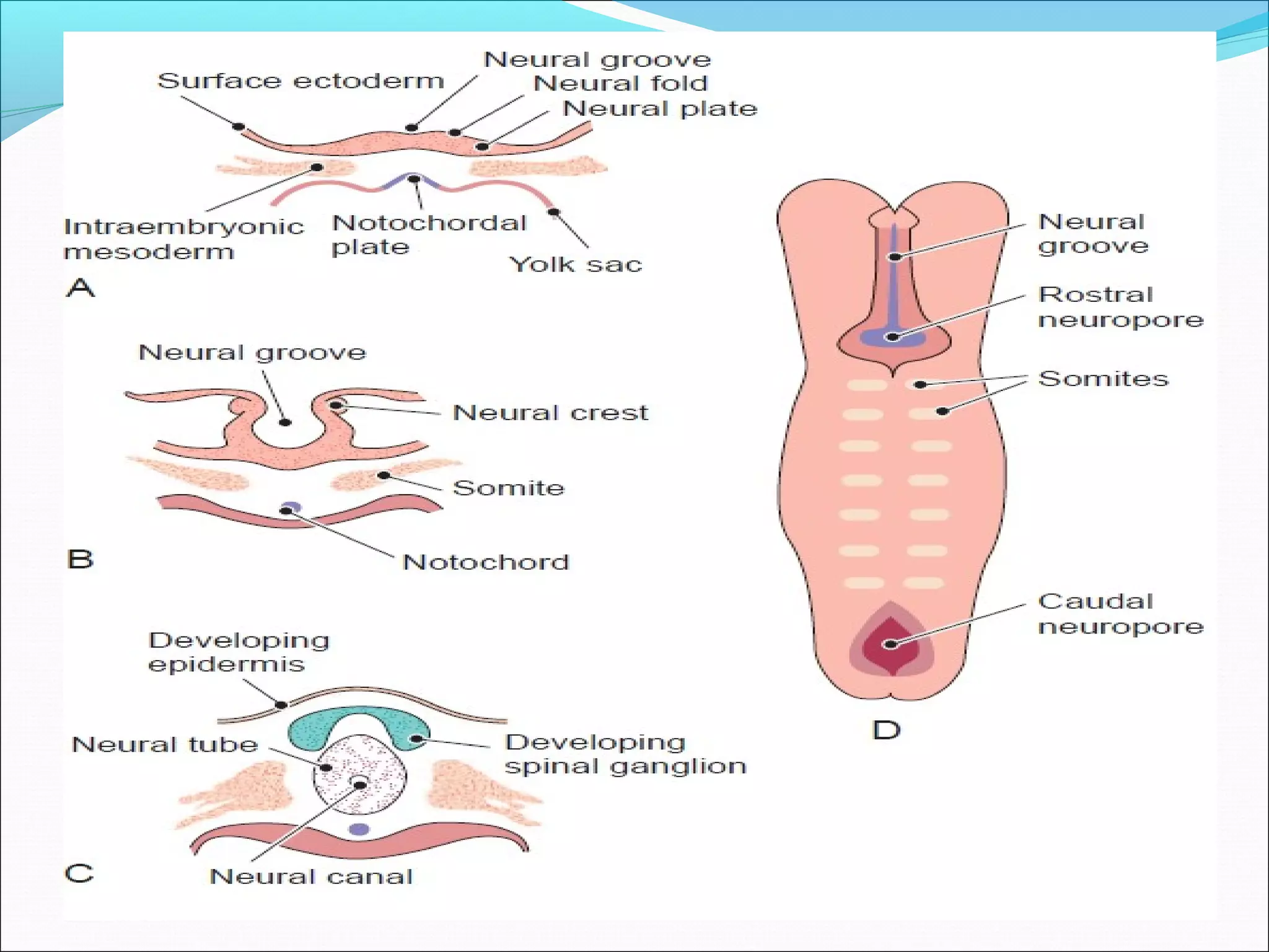 Netural Defect Neural tube defects | PPT