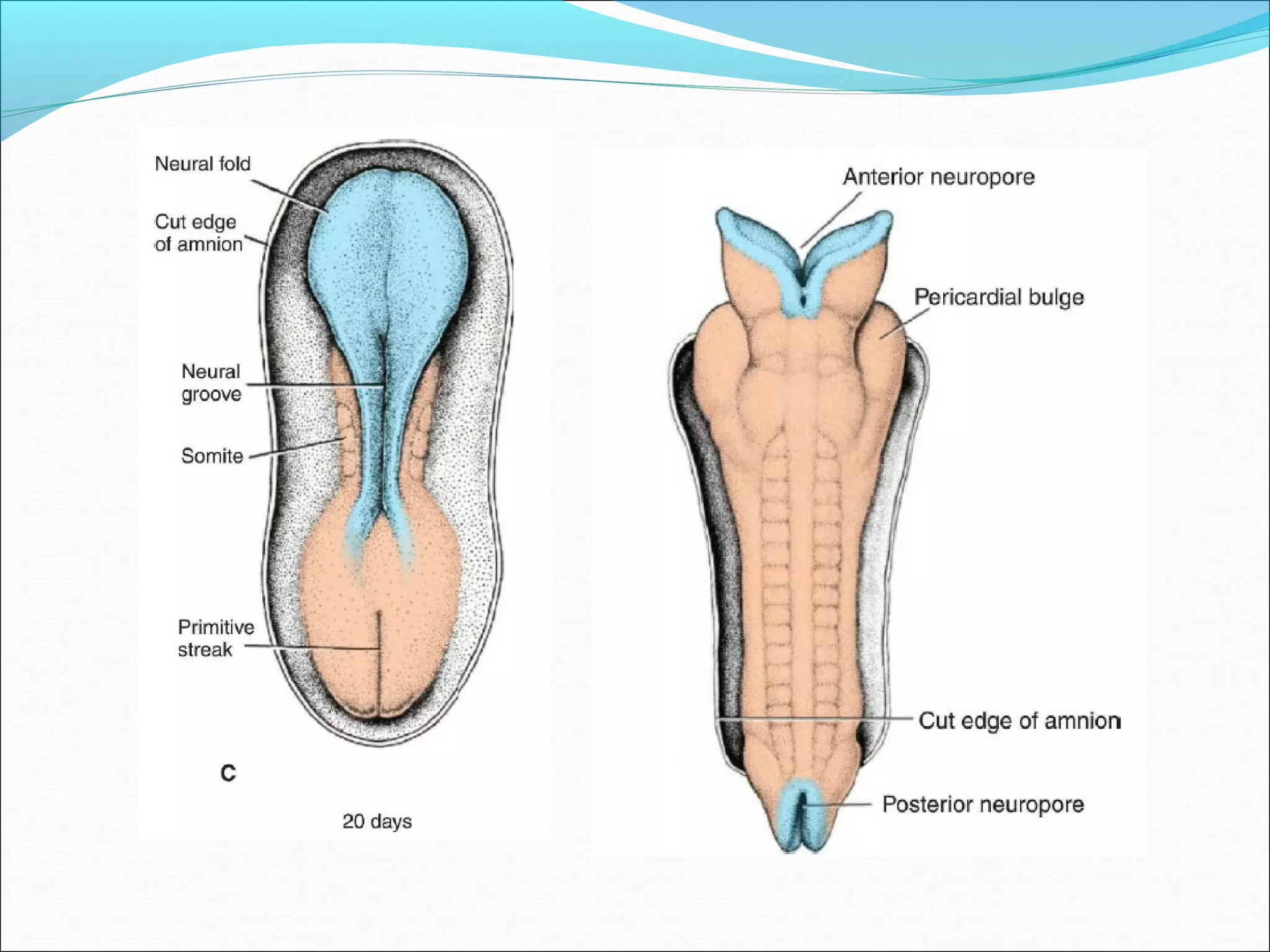 Neutral Defects Neural tube defects | PPT