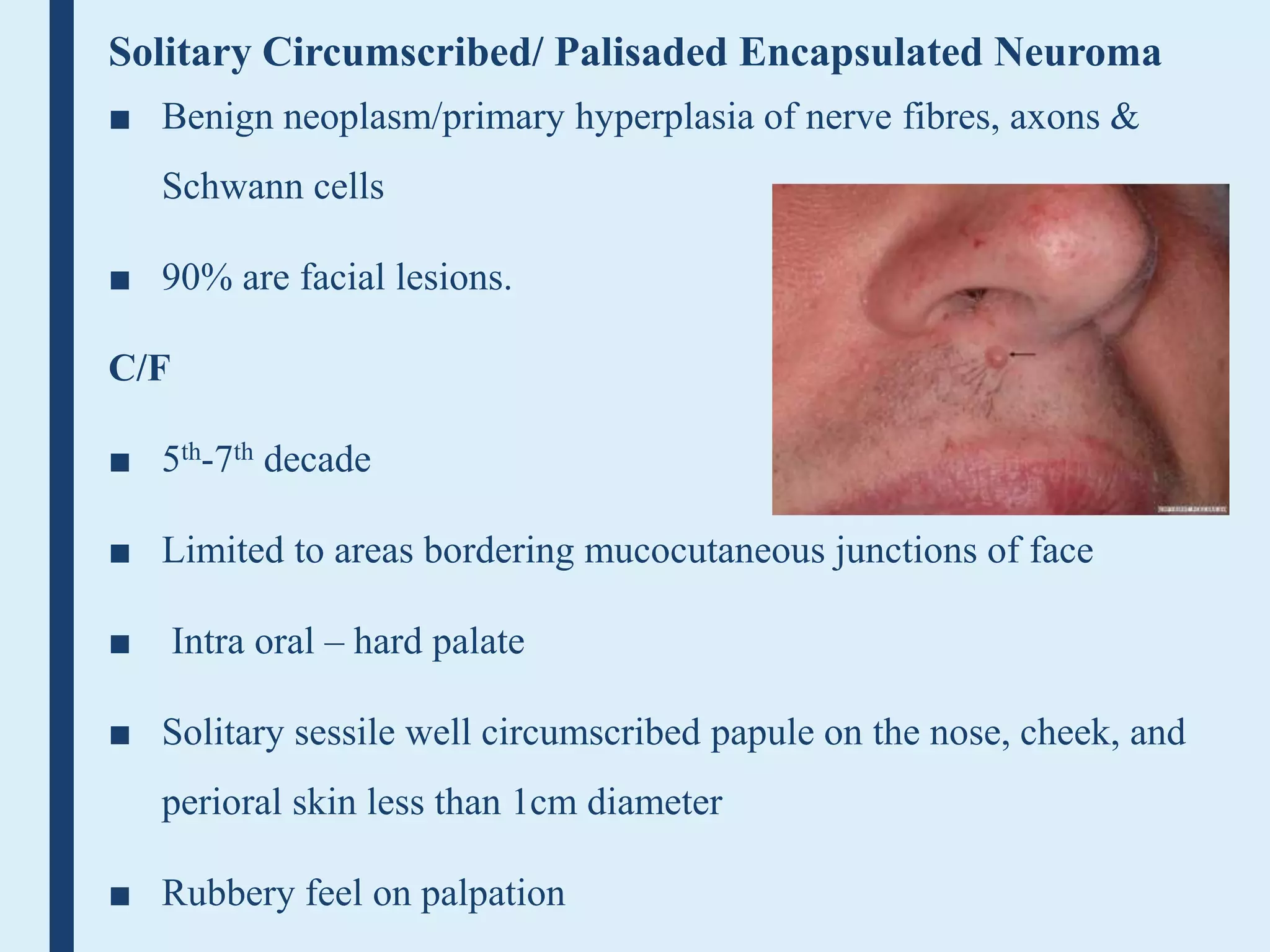 Neural tumors | PPTX