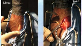 Neurectomy of limbs in equine