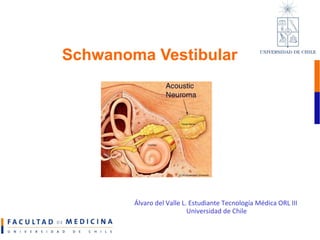 Schwanoma Vestibular Álvaro del Valle L. Estudiante Tecnología Médica ORL III  Universidad de Chile 