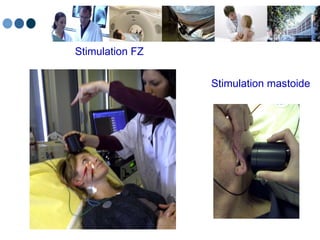 Stimulation FZ Stimulation mastoide 