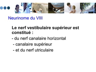 Neurinome du VIII Le nerf vestibulaire supérieur est constitué :   - du nerf canalaire horizontal   - canalaire supérieur    - et du nerf utriculaire 