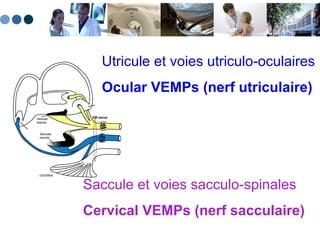 Utricule et voies utriculo-oculaires  Ocular VEMPs (nerf utriculaire) Saccule et voies sacculo-spinales  Cervical VEMPs (nerf sacculaire) 