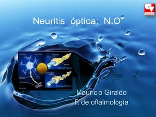 Neuritis óptica: N.O
Mauricio Giraldo
R de oftalmología
 