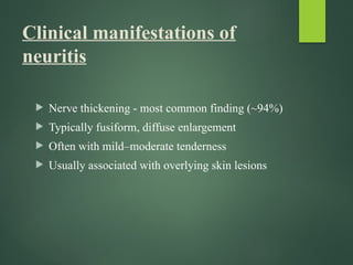 NEURITIS IN LEPROSY (1).pptx dermatology | PPTX