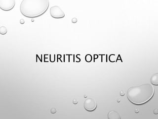 NEURITIS OPTICA
 
