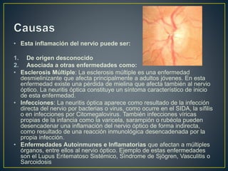 • Esta inflamación del nervio puede ser:
1. De origen desconocido
2. Asociada a otras enfermedades como:
• Esclerosis Múltiple: La esclerosis múltiple es una enfermedad
desmielinizante que afecta principalmente a adultos jóvenes. En esta
enfermedad existe una pérdida de mielina que afecta también al nervio
óptico. La neuritis óptica constituye un síntoma característico de inicio
de esta enfermedad.
• Infecciones: La neuritis óptica aparece como resultado de la infección
directa del nervio por bacterias o virus, como ocurre en el SIDA, la sífilis
o en infecciones por Citomegalovirus. También infecciones víricas
propias de la infancia como la varicela, sarampión o rubéola pueden
desencadenar una inflamación del nervio óptico de forma indirecta,
como resultado de una reacción inmunológica desencadenada por la
propia infección.
• Enfermedades Autoinmunes e Inflamatorias que afectan a múltiples
órganos, entre ellos al nervio óptico. Ejemplo de estas enfermedades
son el Lupus Eritematoso Sistémico, Síndrome de Sjögren, Vasculitis o
Sarcoidosis
 