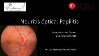 Neuritis óptica: Papilitis
Susana González Gurrola
24 de mayo de 2016
Dr. Luis Fernando Turati Muñoz
 