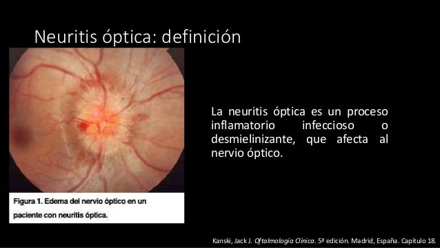 Duele el cuello y la nuca a la tonsilitis